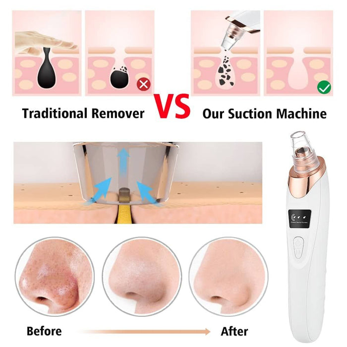 5 in 1 Electric Blackhead Acne Oil Remover Vacuum Suction Face Pore Cleaner Machine